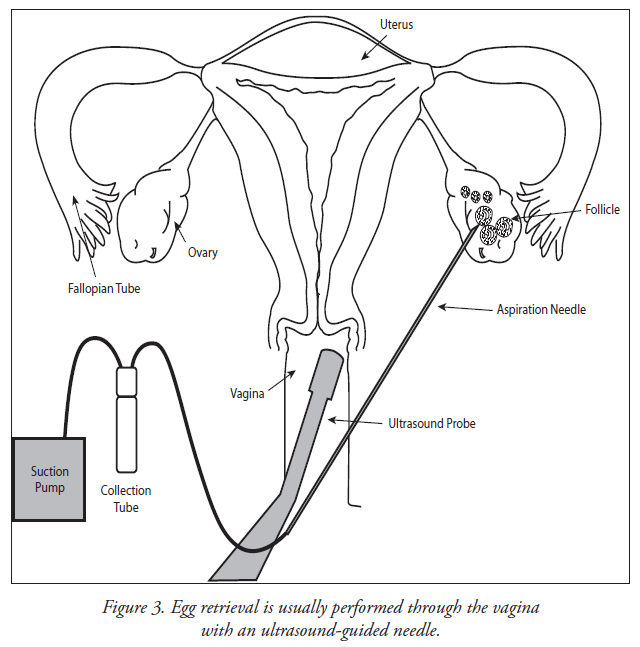 ART Booklet Figure 3